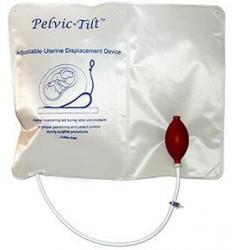 Pelvic-Tilt Adjustable Uterine Displacement Device (5)